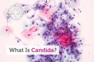 A microscopic view of a candida, a fungus that can cause a fungal infection.