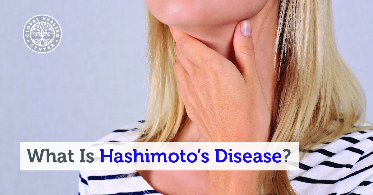 What Is Hashimotos Disease 9744