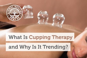 A woman receiving cupping therapy.