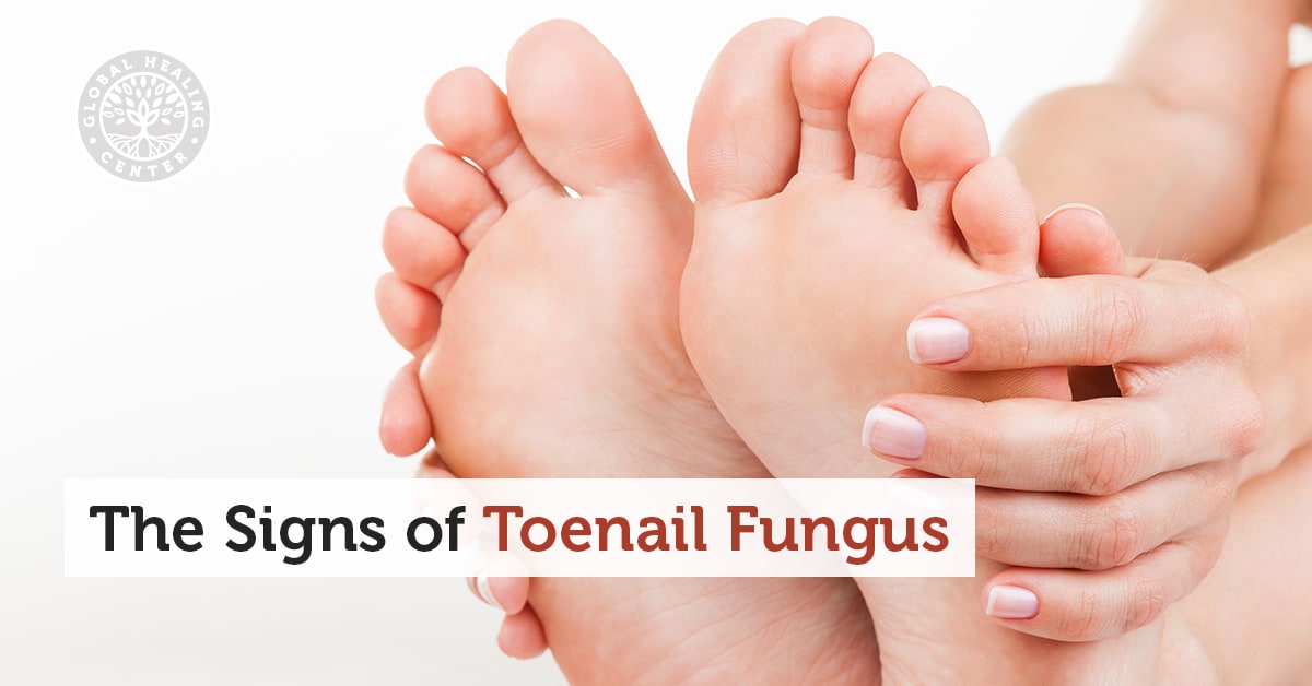 Fungal infections of the nails | Causes & Symptoms | Fix-4-Nails