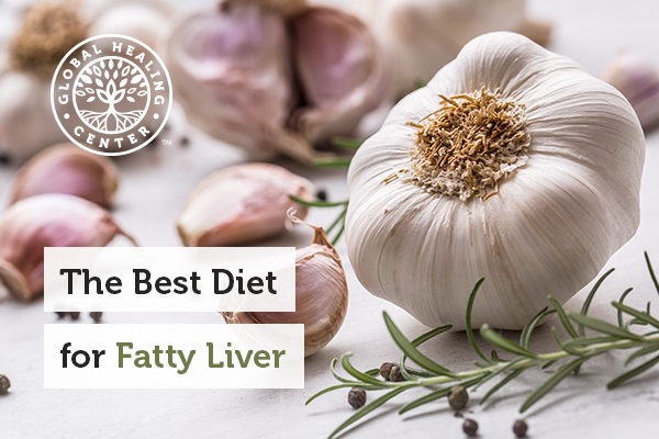 A garlic clove and bulb. Garlic can be part of a fatty liver diet.