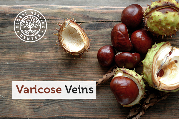 Several horse chestnuts. Horse chestnut seeds and leaves are a natural remedy for varicose veins.