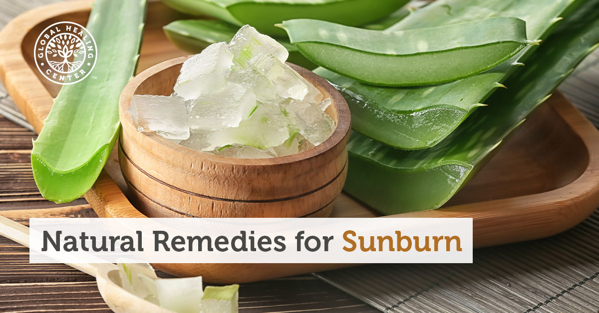 DIY Natural Remedies For Sunburn